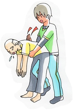 若い男性が背中を丸めて前かがみになった高齢男性を支え、手の付け根で肩甲骨の間を力強くたたいている背部叩打法のイラスト