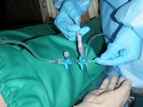 青い手袋を着用した医療従事者が、緑色のシーツで覆われた患者に対して、薬剤を投与している写真