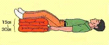 折りたたんだマットのようなものに傷病者の両足を置いて、足を高く上げ、仰向けに寝かせたショック体位を表したイラスト